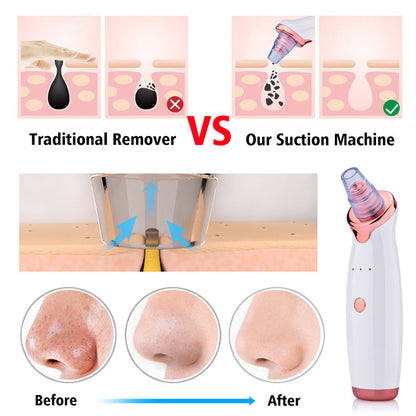 Blackhead Vacuum Remover