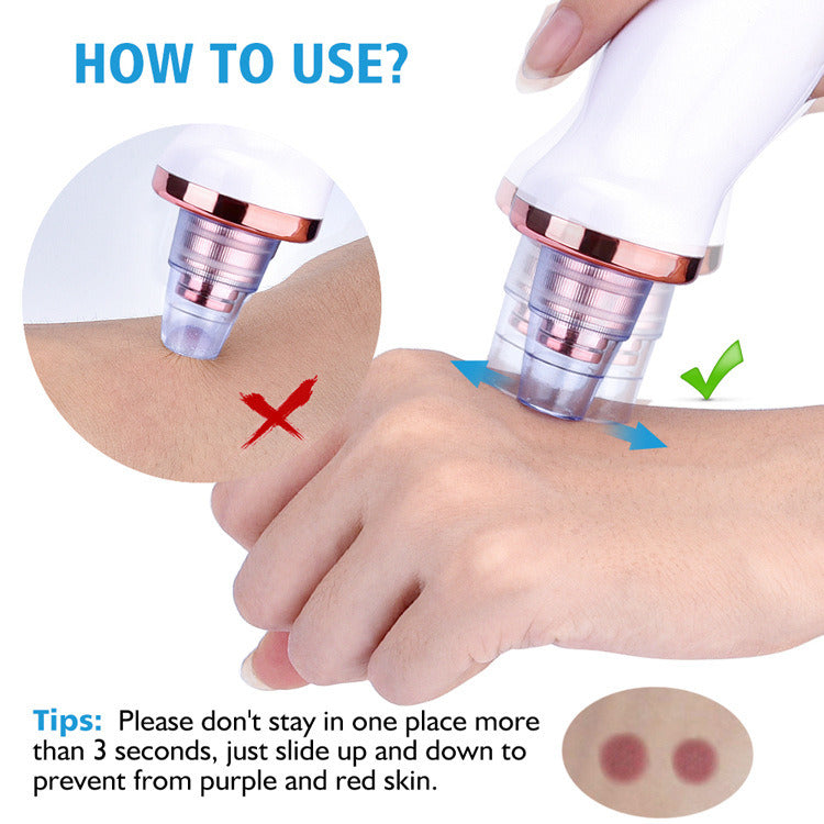 Blackhead Vacuum Remover