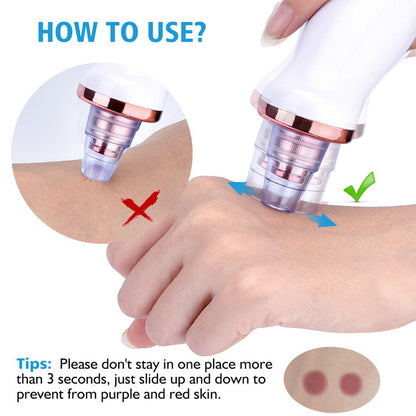 Blackhead Vacuum Remover