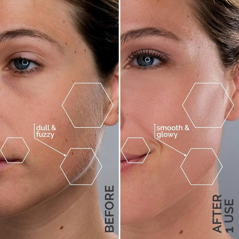 Dermaplaning 2 in 1 Tool (Facial Exfoliation)