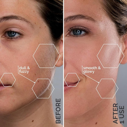 Dermaplaning 2 in 1 Tool (Facial Exfoliation)